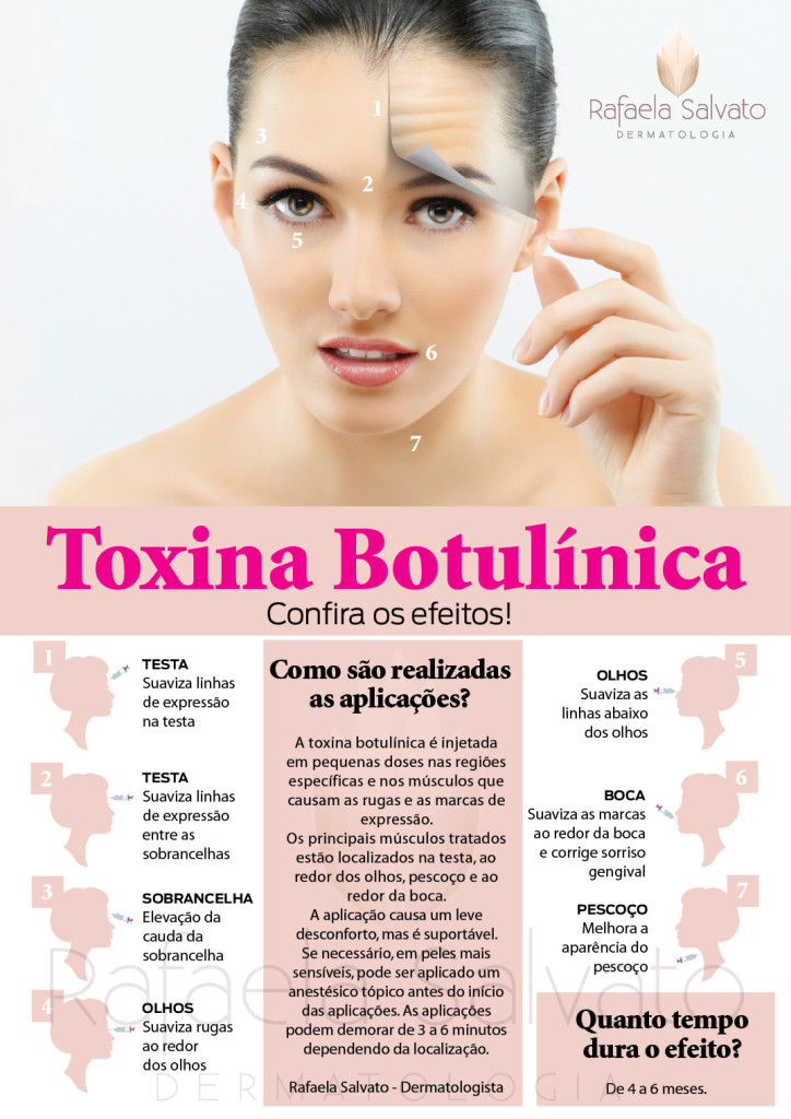 botox infografico Rafaela Salvato Dermatologia